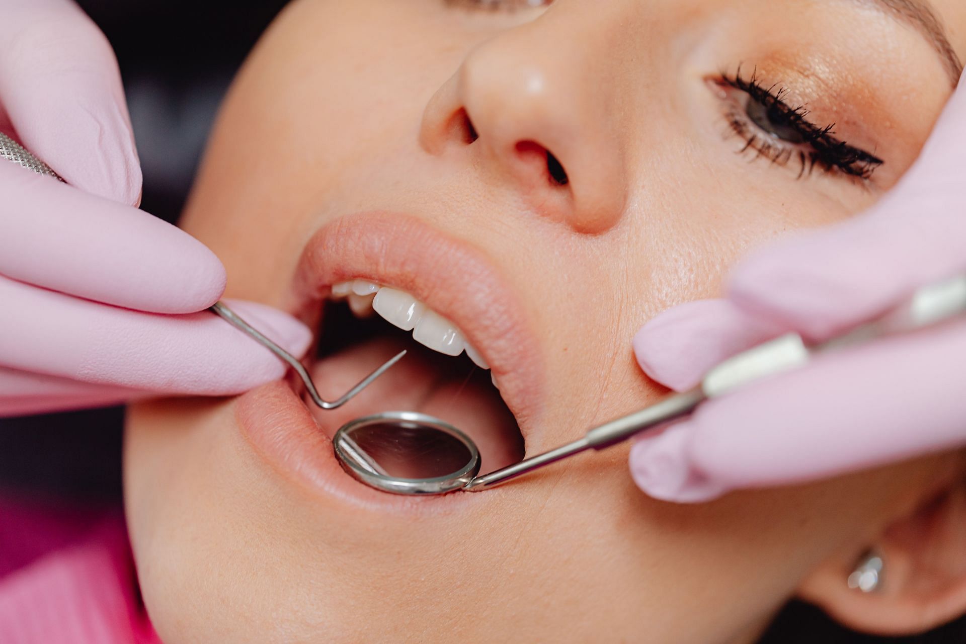 Home remedies for gums recession (Image via Pexels/Karolina Grabowska)